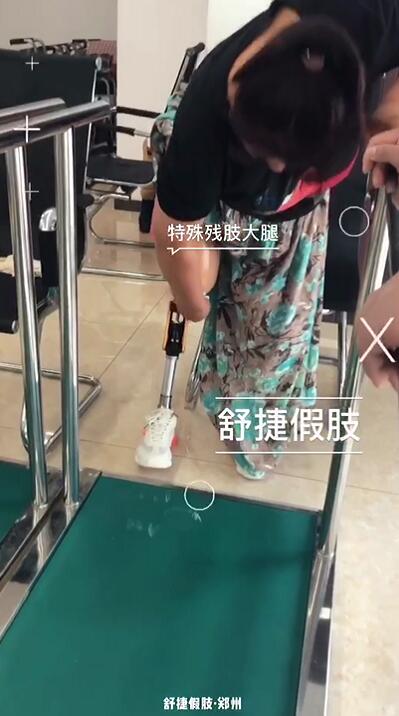 定制大腿假肢廠(chǎng)家
