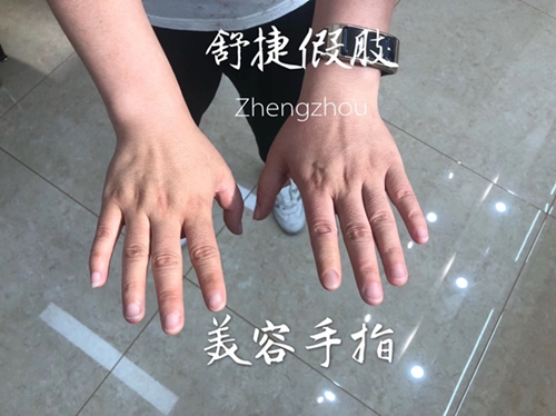 哪里有賣(mài)假手指的？