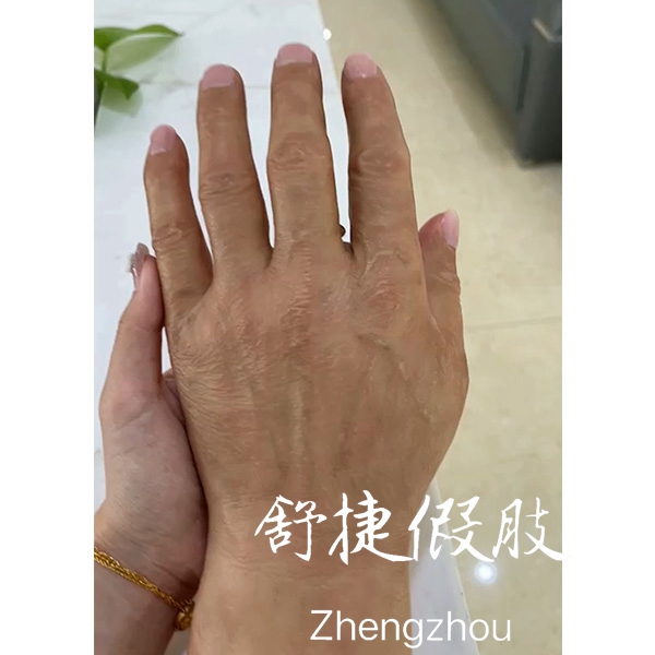 假肢手，高度仿真美容手