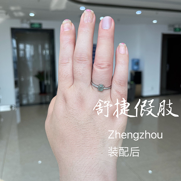 美容假手指裝配后效果，根本看不出來(lái)
